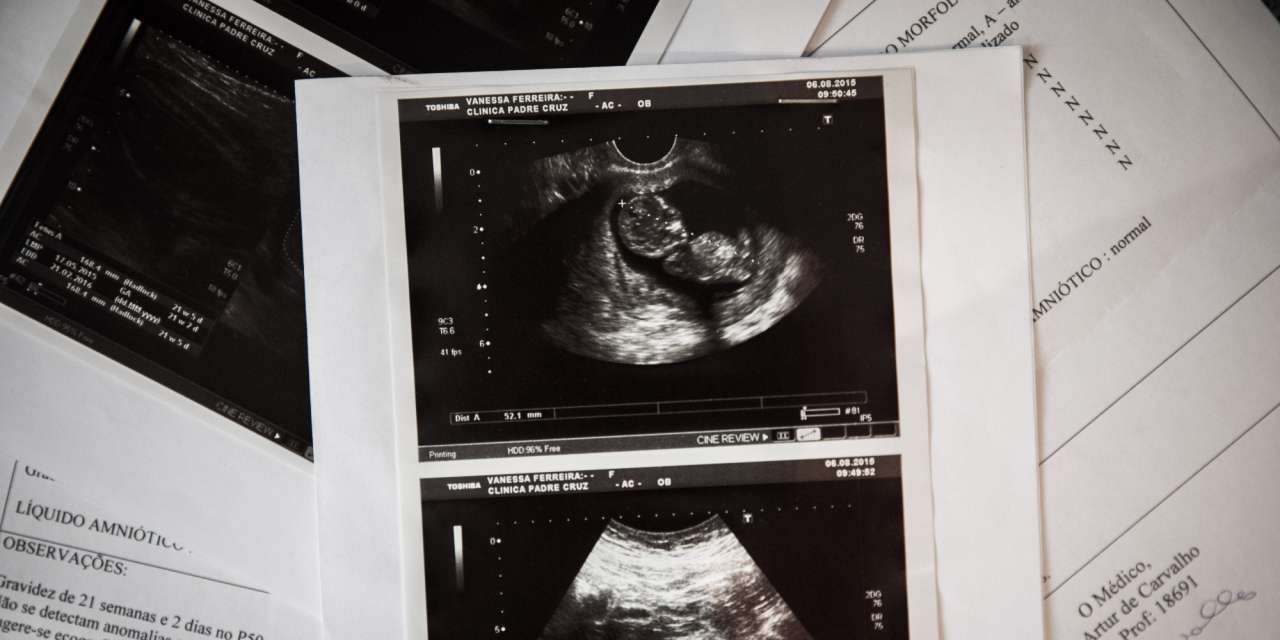 Nenhum dos relatórios das duas ecografias feitas com o obstetra aponta qualquer malformação. Pelo contrário: tudo é identificado como "aparentemente normal"