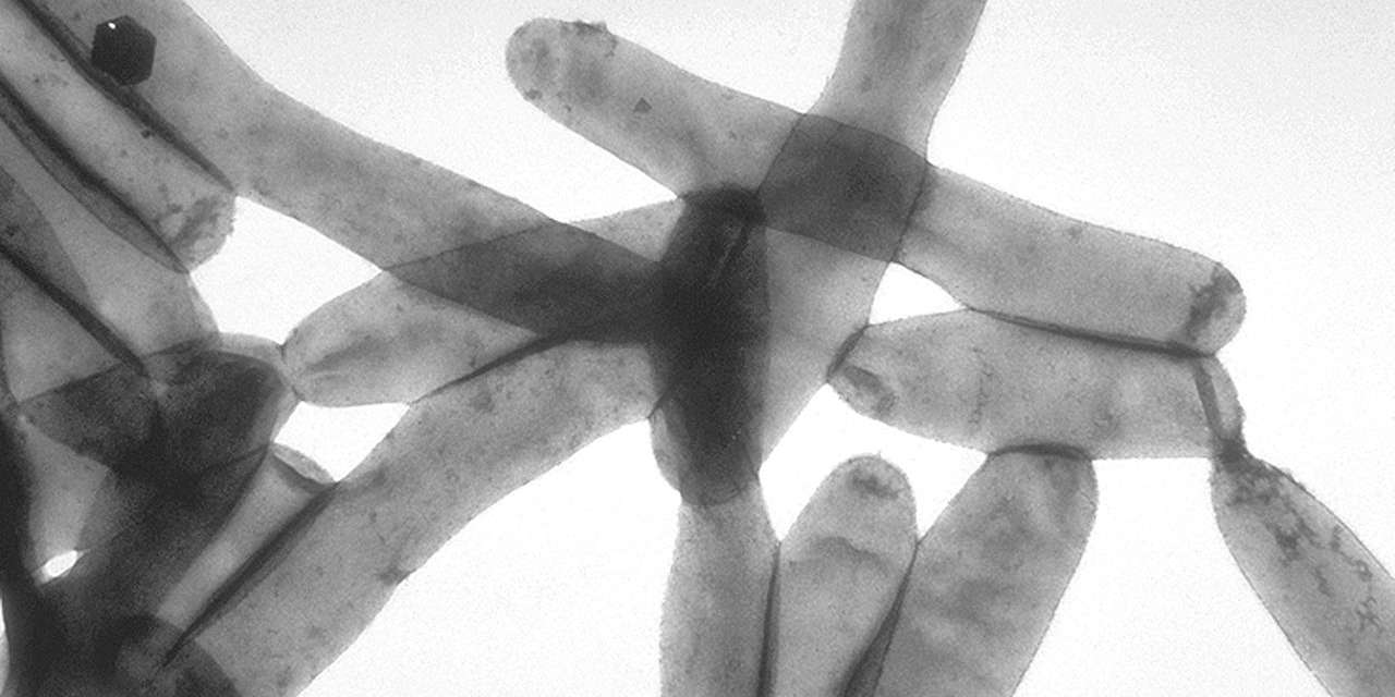 (Imagem ilustrativa) O surto de legionella em Matosinhos, Vila do Conde e Póvoa de Varzim provocou 88 infeções e 15 vítimas mortais