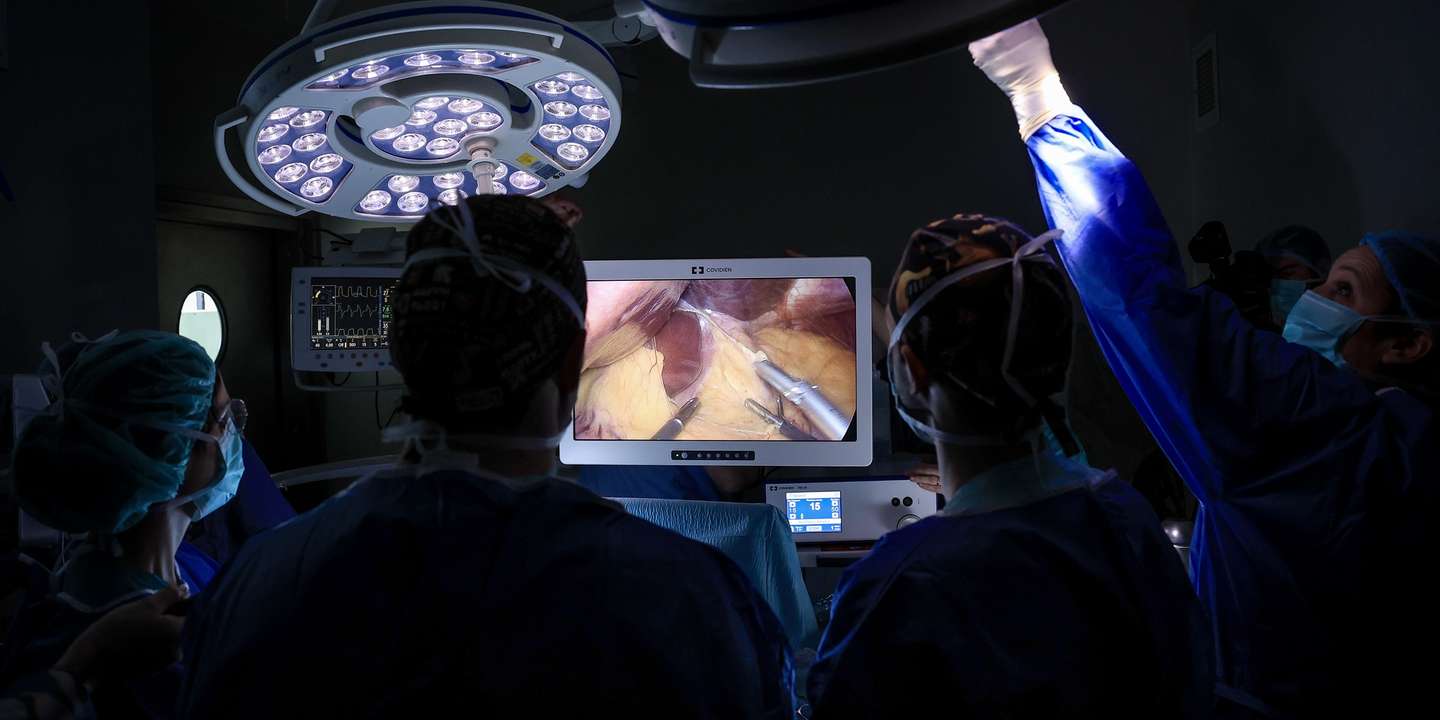 Cirurgia bariátrica em regime de ambulatório, com recurso a uma técnica única no mundo -  ‘koala sleeve’ - que  foi apresentada em maio de 2024 no Congresso Europeu de Cirurgia de Obesidade em Viena, na Áustria, Hospital Pedro Hispano, em Matosinhos, 3 de março de 2025. O ‘sleeve’ – gastrectomia vertical ou cirurgia de redução do estômago – consiste na remoção de cerca de 70% do estômago fazendo com que este em vez de se parecer com um saco que armazena comia, fique como uma banana, um tubo estreito.Na prática, a ‘koala sleeve’ consiste na adaptação do ‘sleeve’ tradicional, acrescentando-lhe a colocação de uma espécie de válvula que tenta impedir o refluxo dos alimentos do estômago para o esófago. ( ACOMPANHA TEXTO) JOSÉ COELHO/LUSA