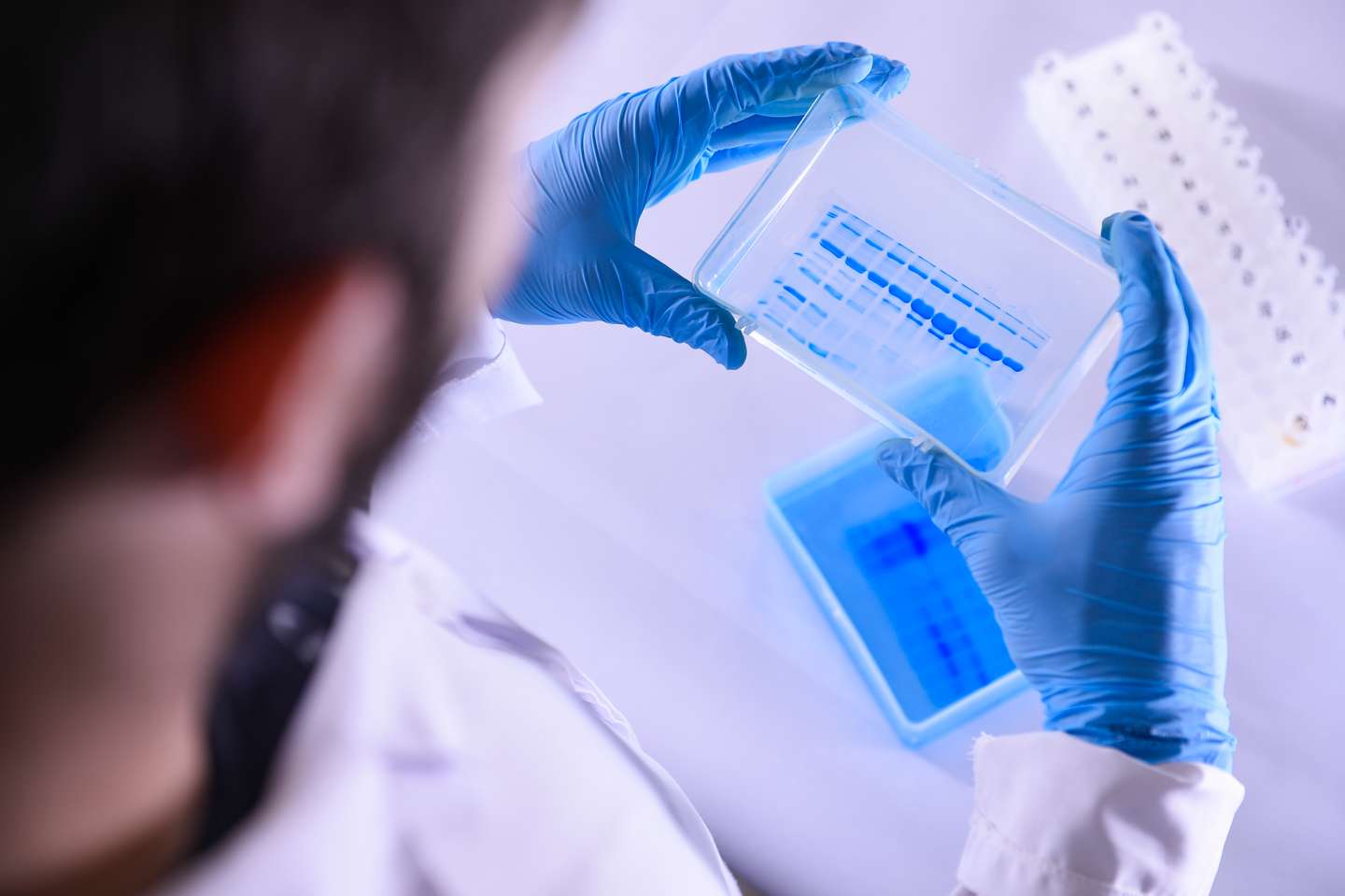 The Technological Vaccine Center of the Federal University of Minas Gerais is Testing a Vaccine against the Coronavirus (COVID - 19) and also Testing Diagnosis Kits