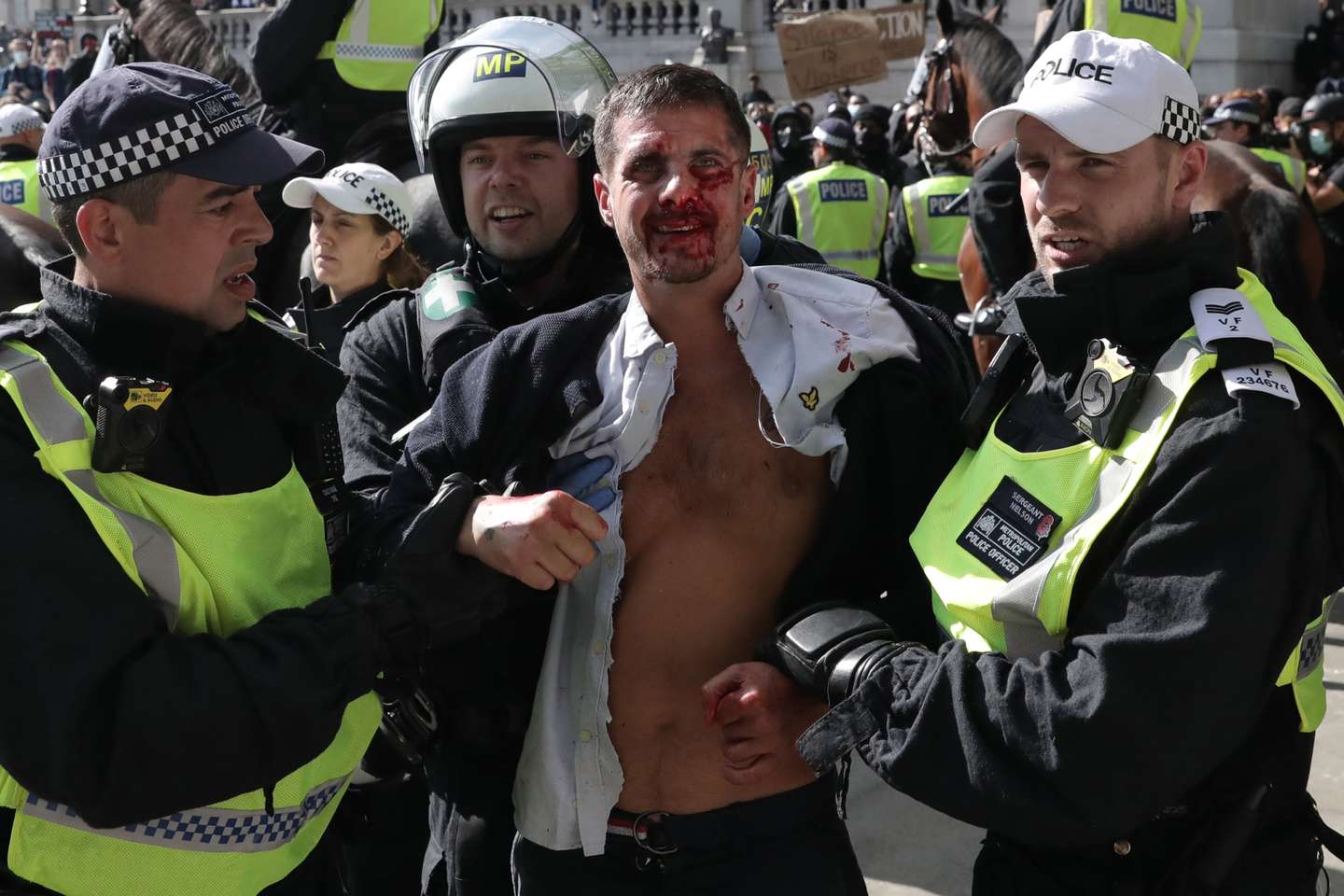 Far-Right Protesters React To Anti-Racism Demonstrations