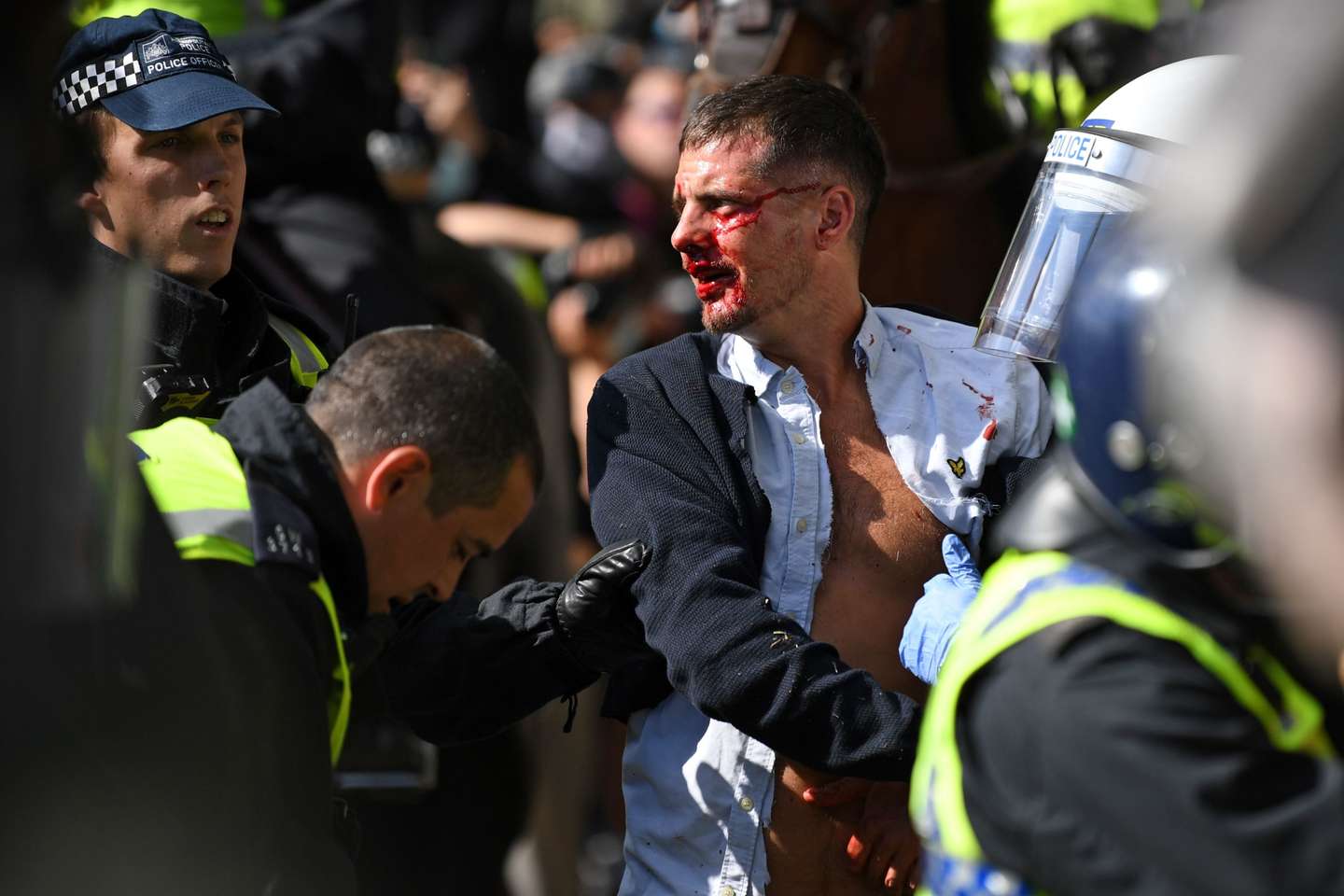 BRITAIN-POLITICS-POLICE-PROTEST-RACISM