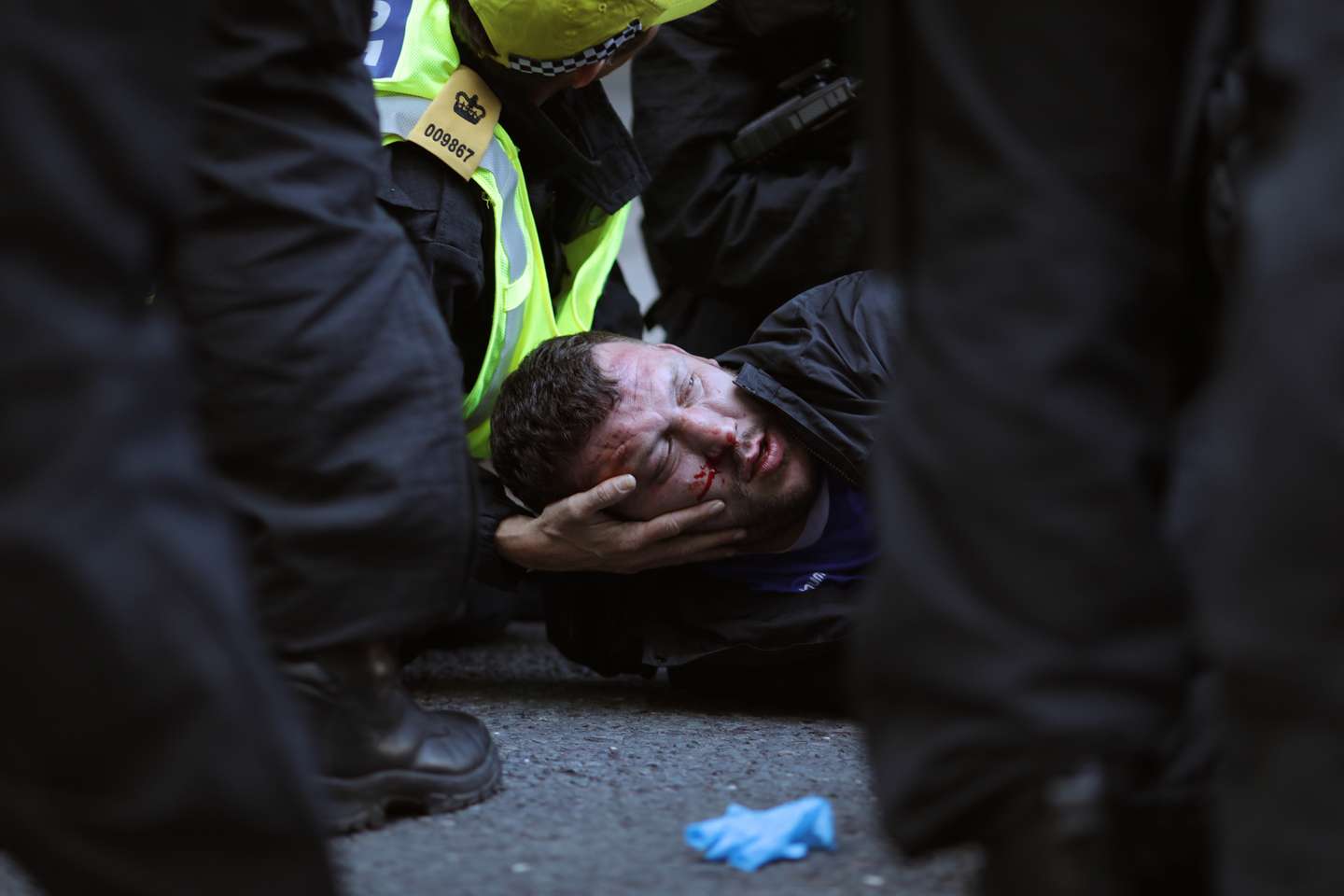 Far-Right Protesters React To Anti-Racism Demonstrations