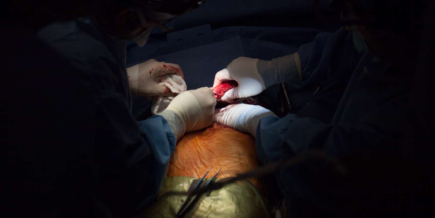 Double-lung Transplant Surgery