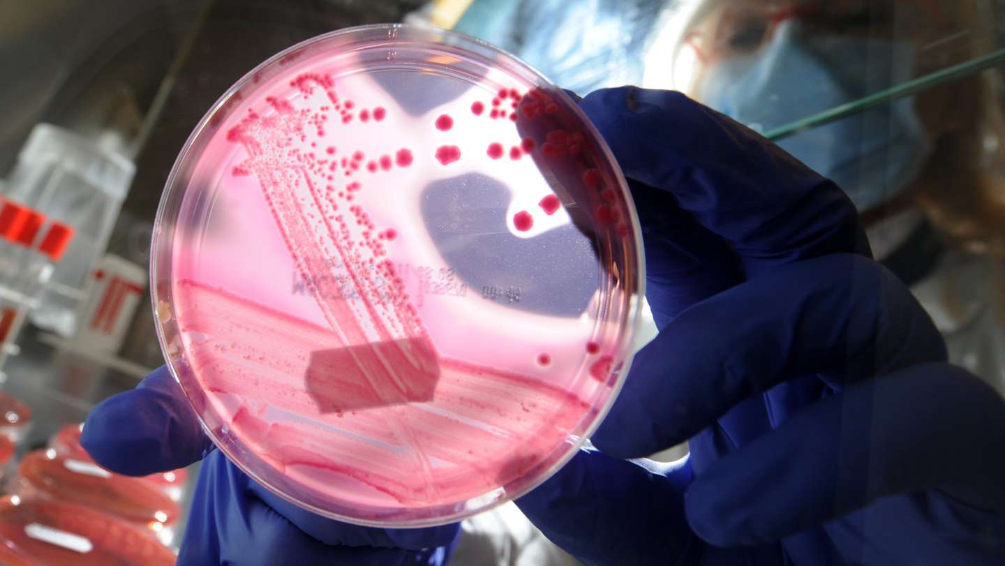 GERMANY-HEALTH-DISEASE