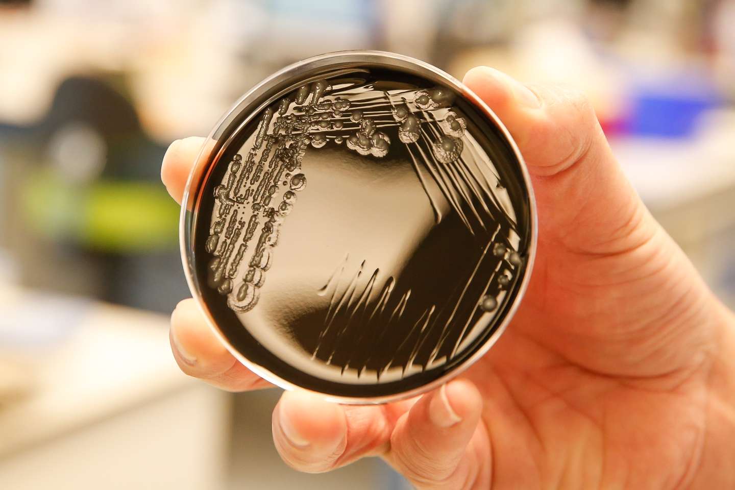 BELGIUM-HEALTH-LEGIONELLA-BACTERIA-RESEARCH