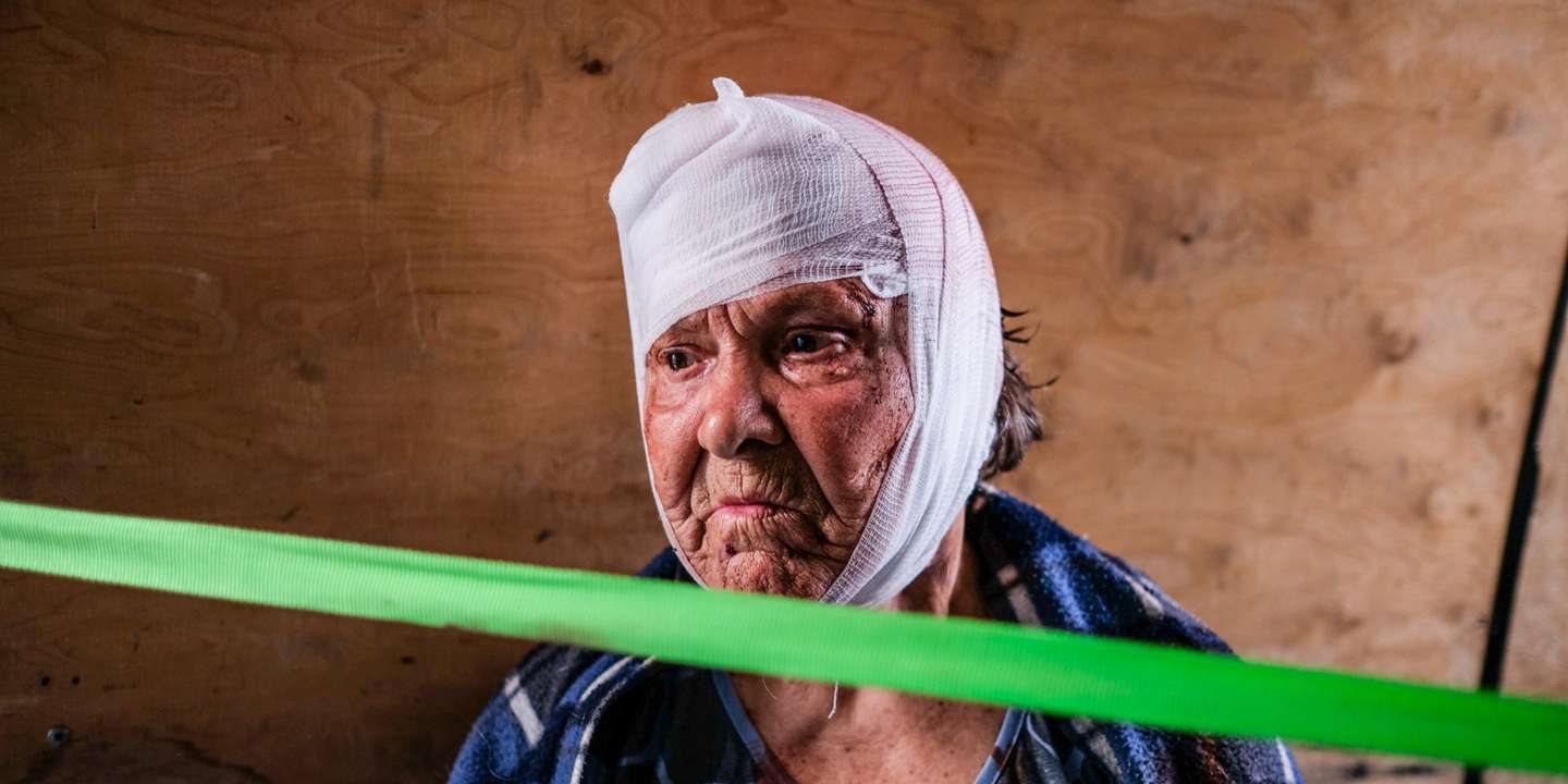 A woman injured by the Russian shelling is being treated and