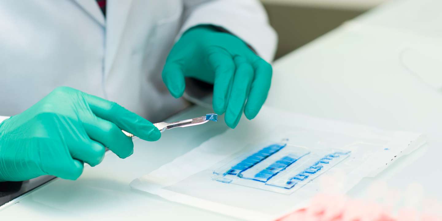 Proteomics: identification of proteins present in the samples. The electrophoresis gel bands containing proteins are recovered and placed in tubes.