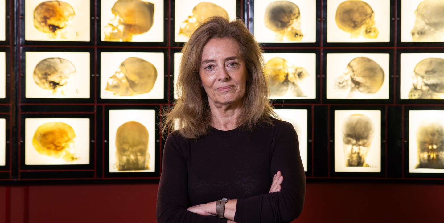 Isabel Pavão Martins, neurologista há 30 anos, é coordenadora da Consulta de Cefaleias, no Hospital de Santa Maria, em Lisboa