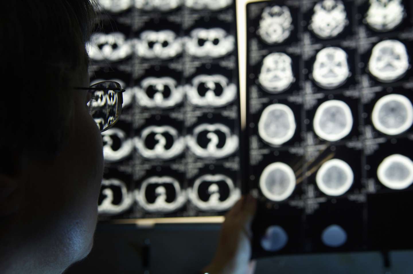 Radiologist examining various CT scans