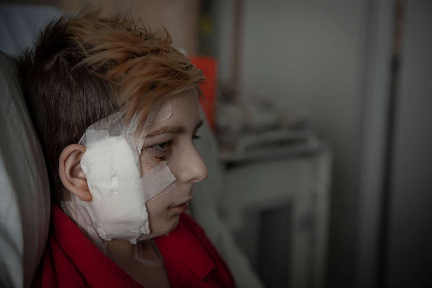 Reportagem no maior hospital pediátrico de Kiev numa altura em que estão a receber crianças que chegam feridas devido à guerra entre a Ucrânia e a Rússia. A Rússia, a mando do seu presidente, Vladimir Putin, invadiu a Ucrânia no passado dia 24 de fevereiro de 2022. Kiev, Ucrânia, 17 de março de 2022. JOÃO PORFÍRIO/OBSERVADOR