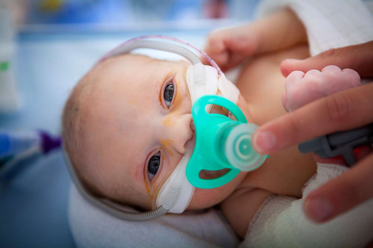Neonatology