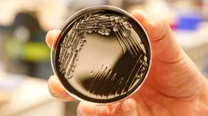BELGIUM-HEALTH-LEGIONELLA-BACTERIA-RESEARCH