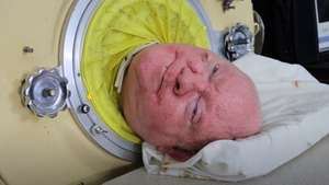 Paul Alexander - Iron Lung Survivor