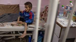epa12147328 Five year-old Osama al-Raqab, suffering from severe malnutrition, undergoes treatment at the Nasser Hospital in Khan Youni in the southern Gaza Strip 31 May 2025. His mother, Mona al-Raqab says Osama's weight has dropped to just nine kilograms due to his deteriorating health condition caused by ongoing malnutrition. The UN has stated that families are being starved and denied the basic means for survival and only a trickle of aid that falls short of people's massive needs has entered the Gaza Strip after more than 80 days of a total blockade by Israeli authorities. The UN stated that Gaza is the only territory in the world where an entire population is at risk of famine.  EPA/HAITHAM IMAD ATTENTION EDITORS: UPSETTING CONTENT