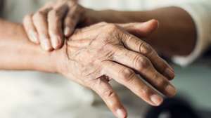Parkinson