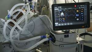 Um paciente hospitalizado na Unidade de Cuidados Intensivos covid-19 do Hospital Santa Maria, em Lisboa, 11 de fevereiro de 2021. O Hospital Santa Maria conta ao dia de hoje com 271 doentes internados com  64 destes doentes internados nos Cuidados Intensivos covid-19, o número máximo atingido até ao dia de hoje neste Hospital. (ACOMPANHA TEXTO DA LUSA DO DIA 14 DE FEVEREIRO DE 2021). MIGUEL A. LOPES/LUSA
