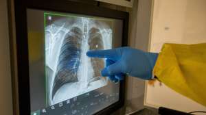 epa08319675 A doctor at the polyclinic Klinicare performs an x-ray of the lungs of a potential patient with COVID-19 in Brussels, Belgium, 24 March 2020. In order to contain the spread of the novel coronavirus, Belgium has implemented confinement guidelines for the public, which are set to stay in place until 05 April 2020. Only supermarkets and essential trade can remain operational. More than 4,000 cases of people infected with Covid-19 have been registered in the country, with over 120 deaths.  EPA/STEPHANIE LECOCQ