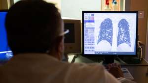 epa08691184 A doctor of the Casal Palocco Clinical institute checks the x-ray of the lungs of a hospitalized boy with COVID19 in, Rome, Italy, 23 September 2020. The Clinical institute, transformed into a hospital for COVID19 patients during the coronavirus emergency, reached zero cases during July. Hospitalizations and intensive care recovery for COVID19 at the COVID19 center in Casal Palocco, have increased since August reaching the peak in the last week and mainly concerns young people.  EPA/Emanuele Valeri