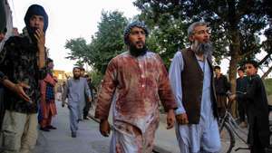 epaselect epa09917096 People who were injured leave the scene of the bomb blast in Kabul, Afghanistan, 29 April 2022. According to police, at least ten people were killed and dozens more injured in a bombing attack on a mosque during prayers, the attack came amid a wave of strikes on Afghan religious sites and civilian targets during the holy month of Ramadan.  EPA/STRINGER