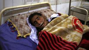 epa11238993 A patient suffering from Tuberculosis (TB), receives medical treatment at the Lady Reading government hospital, on the eve of World Tuberculosis Day, in Peshawar, Pakistan, 23 March 2024. Dr. Anila Basit, Associate Professor of Pulmonology at Lady Readings Hospital, revealed alarming statistics on tuberculosis (TB) prevalence worldwide. With an annual incidence of 276 cases per 100,000 population, and a prevalence rate soaring to 348 cases, the disease continues to pose a significant public health challenge. Even more distressing is the mortality rate, with 34 deaths per 100,000 population annually.  EPA/ARSHAD ARBAB