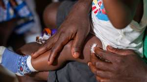 epa11096738 A mother holds her child after receiving the vaccine against malaria in Nyalla Medical Centre in Douala, Cameroon, 22 January 2024. A new malaria vaccine, known as RTS,S, or Mosquirix, made by GlaxoSmithKline, is being rolled out for the first time as an immunization campaign for children in Cameroon. According to the World Health Organisation, the WHO African Region, with an estimated 233 million cases in 2022, accounted for about 94% of cases globally. Malaria is highly endemic in Cameroon and the WHO estimates that about 11,000 people die from malaria in Cameroon every year.  EPA/DONGMO RODRIGUE WILLIAM