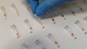 epaselect epa08730816 View of the extraction of the genetic code or ribonucleic acid (RNA) of the coronavirus, the same that is amplified to continue with the processing and achieve the result by means of a color reaction, positive yellow, negative red, in the laboratory of Hipolito Unanue Hospital, in Lima, Peru, 08 October 2020. The hospital is the second in Peru to launch the use of rapid molecular tests, a new technology that saves time to detect the presence of the virus in a similar way to PCR. These molecular tests, the results of which are ready in about 45 minutes, use the RT-LAMP technique (loop-mediated isothermal amplification), a method that is usually applied in Peru for the diagnosis of dengue, Zika and tuberculosis.  EPA/Paolo Aguilar