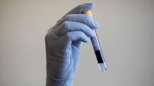 British Government Offers Antibody Tests To NHS And Care Home Staff