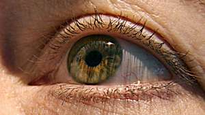 US-HEALTH-EYES