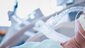 Weaning off Endotrachel tube giving oxygen to human