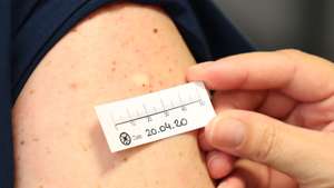 Vacina da BCG contra a tuberculose