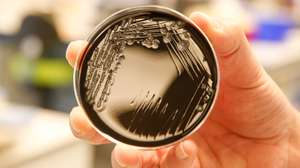 A bactéria da Legionella