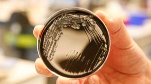 A bactéria da Legionella