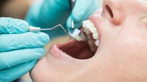 Relatório de saúde oral recomenda realização de mais consultas