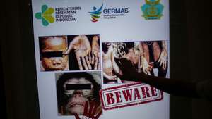 Monkeypox virus detection in Indonesia