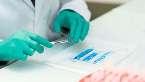 Proteomics: identification of proteins present in the samples. The electrophoresis gel bands containing proteins are recovered and placed in tubes.