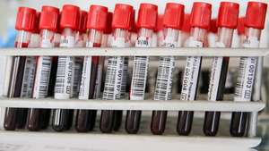 Blood donation campaign in Vladikavkaz, Russia