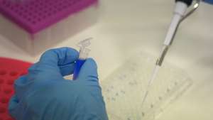 Presentation Of The First Clinical Trial Of Oncomatryx For Patients With Metastatic Tumors