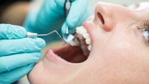 Relatório de saúde oral recomenda realização de mais consultas
