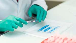 Proteomics: identification of proteins present in the samples. The electrophoresis gel bands containing proteins are recovered and placed in tubes.