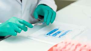 Proteomics: identification of proteins present in the samples. The electrophoresis gel bands containing proteins are recovered and placed in tubes.