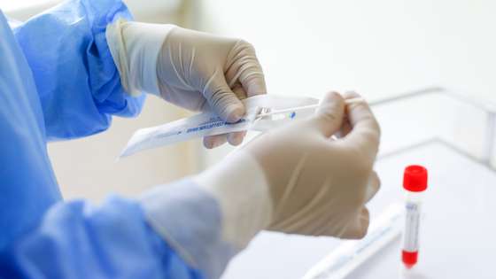 Peru Has Now World's Highest Coronavirus Mortality Rate After Official Revision