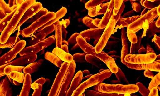 Mycobacterium_tuberculosis_MEB_NIAID_2