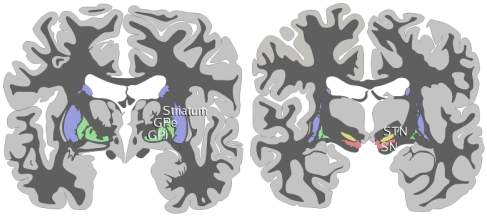 Basal-ganglia-coronal-sections_Andrew Gillies