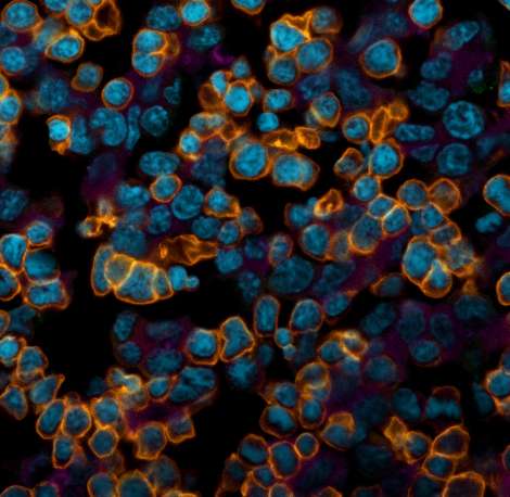 Celulas estaminais hematopoeticas_Silvia Madeira_IMM