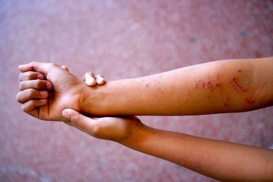 12 to 18 years old, abuse, children living/working on the streets, girl, homeless, Philippines, 