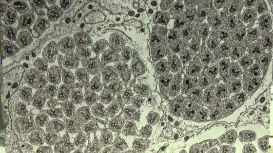 Testiculos-de-mosca_770x433_acf_cropped
