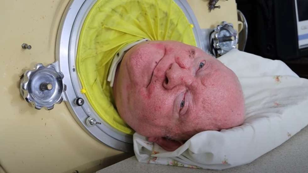 Paul Alexander - Iron Lung Survivor