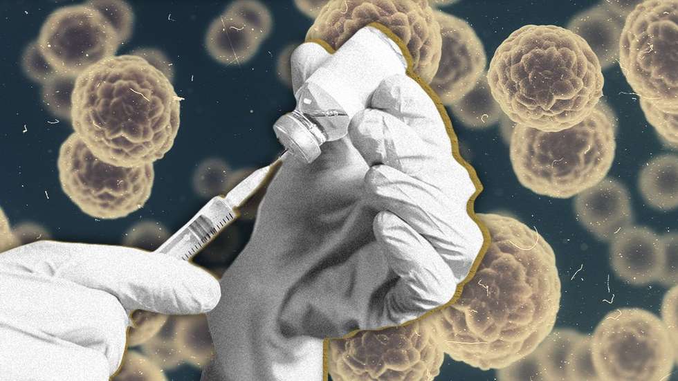 O ECDC espera um aumento do número de casos durante a próxima primavera, oito em cada 10 pessoas que foram diagnosticadas com sarampo na UE/EEE em 2024 não estavam vacinadas