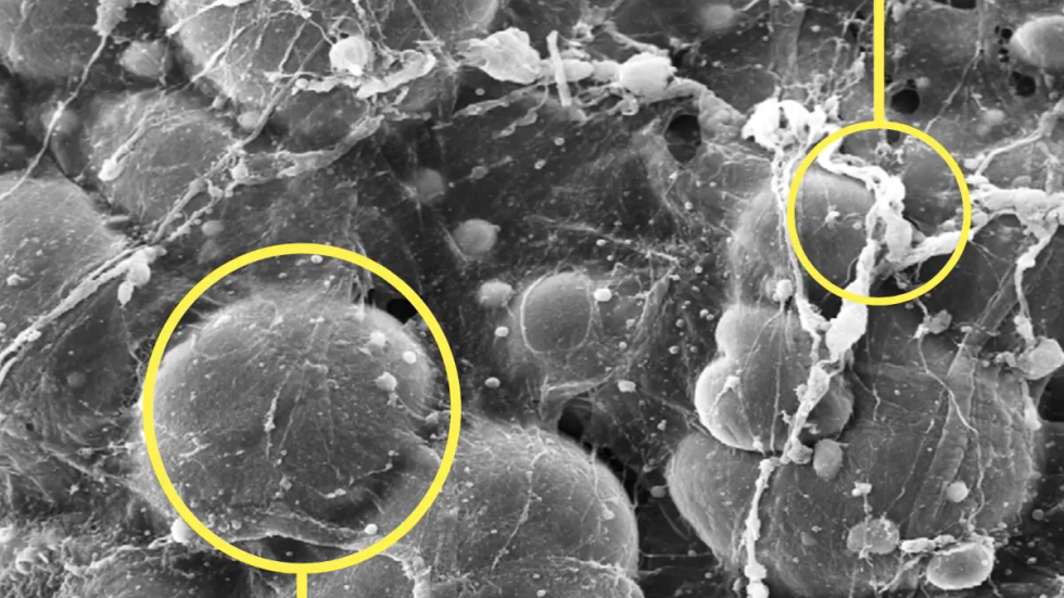 ALLOCLAE 250X MAGNIFICATION